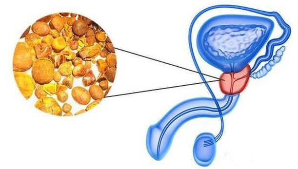 Apskaičiuoja prostatos liauką