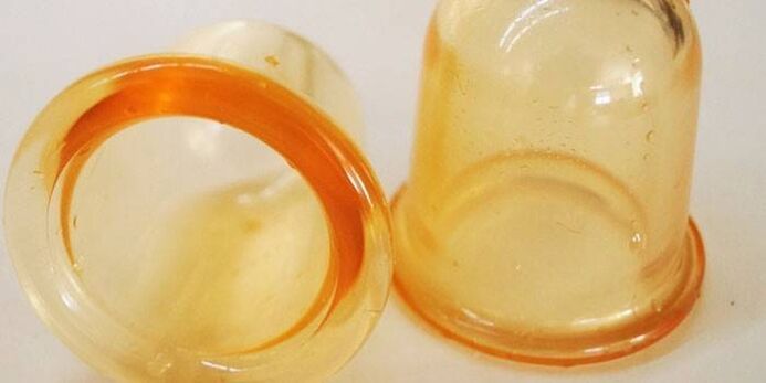 puodeliai prostatito gydymui