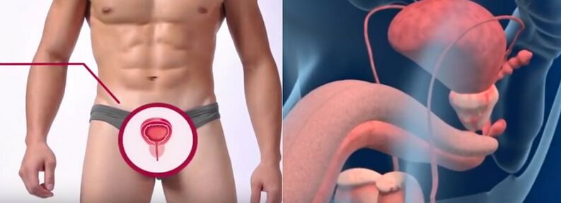 Prostatitas vyrams, atpažįstamas pagal tam tikrus požymius